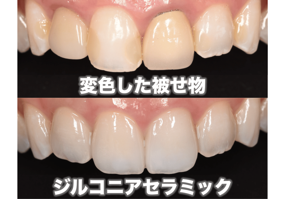 ①自然な見た目が長続きする