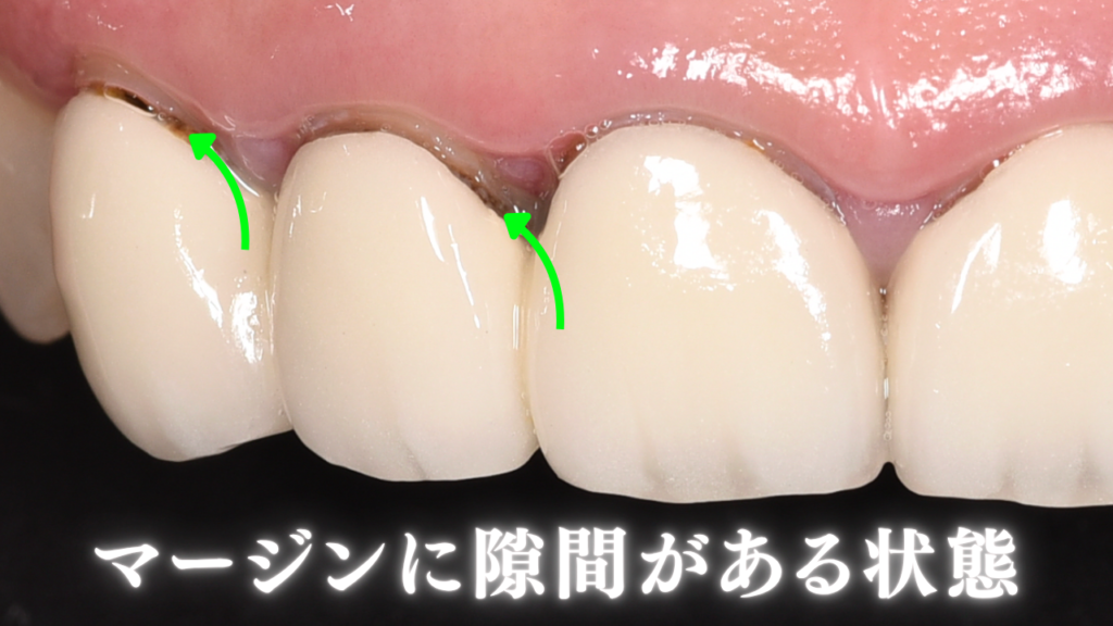 マージンに隙間がある状態